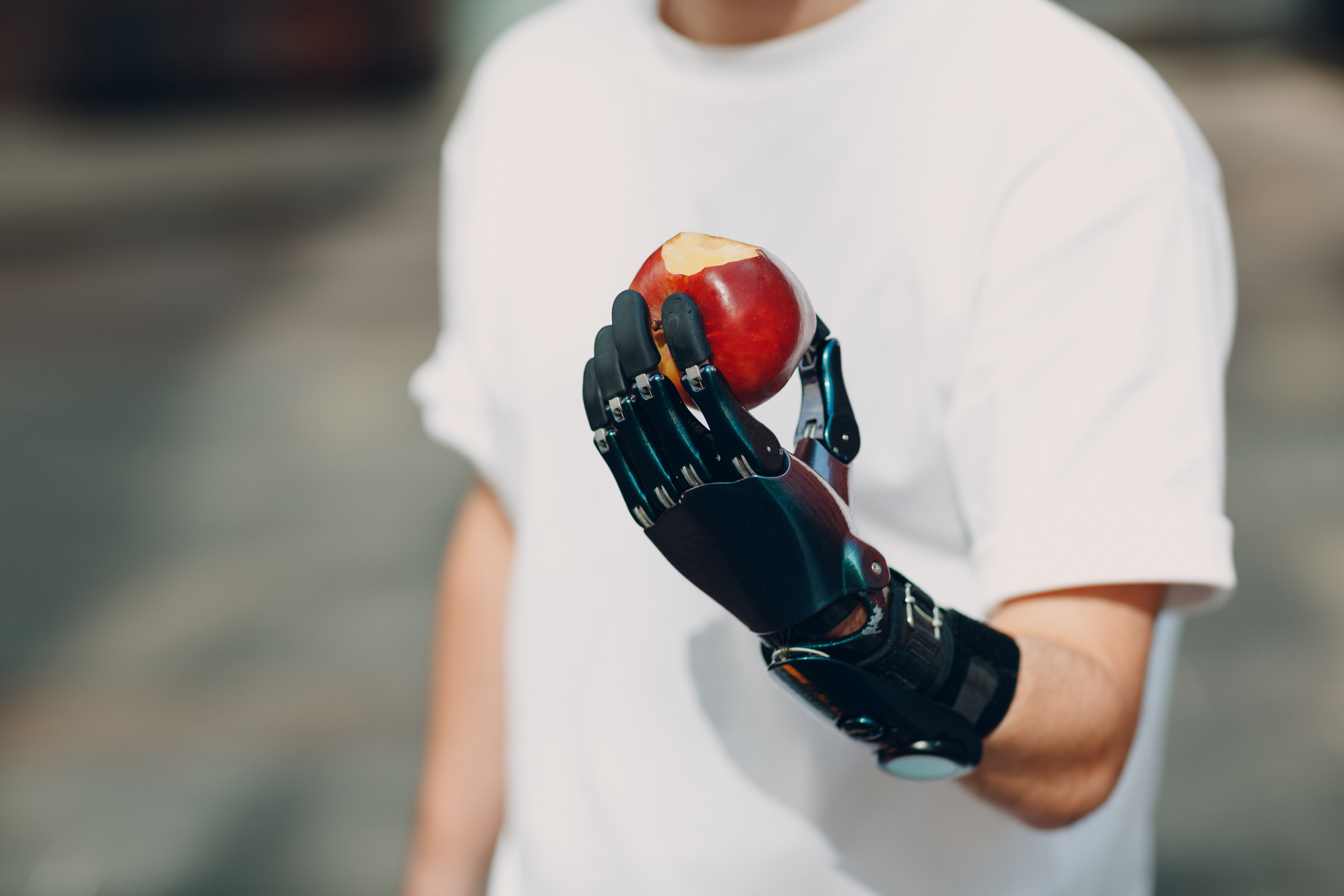 Young Disabled Man with Artificial Prosthetic Hand in Casual Clothes.