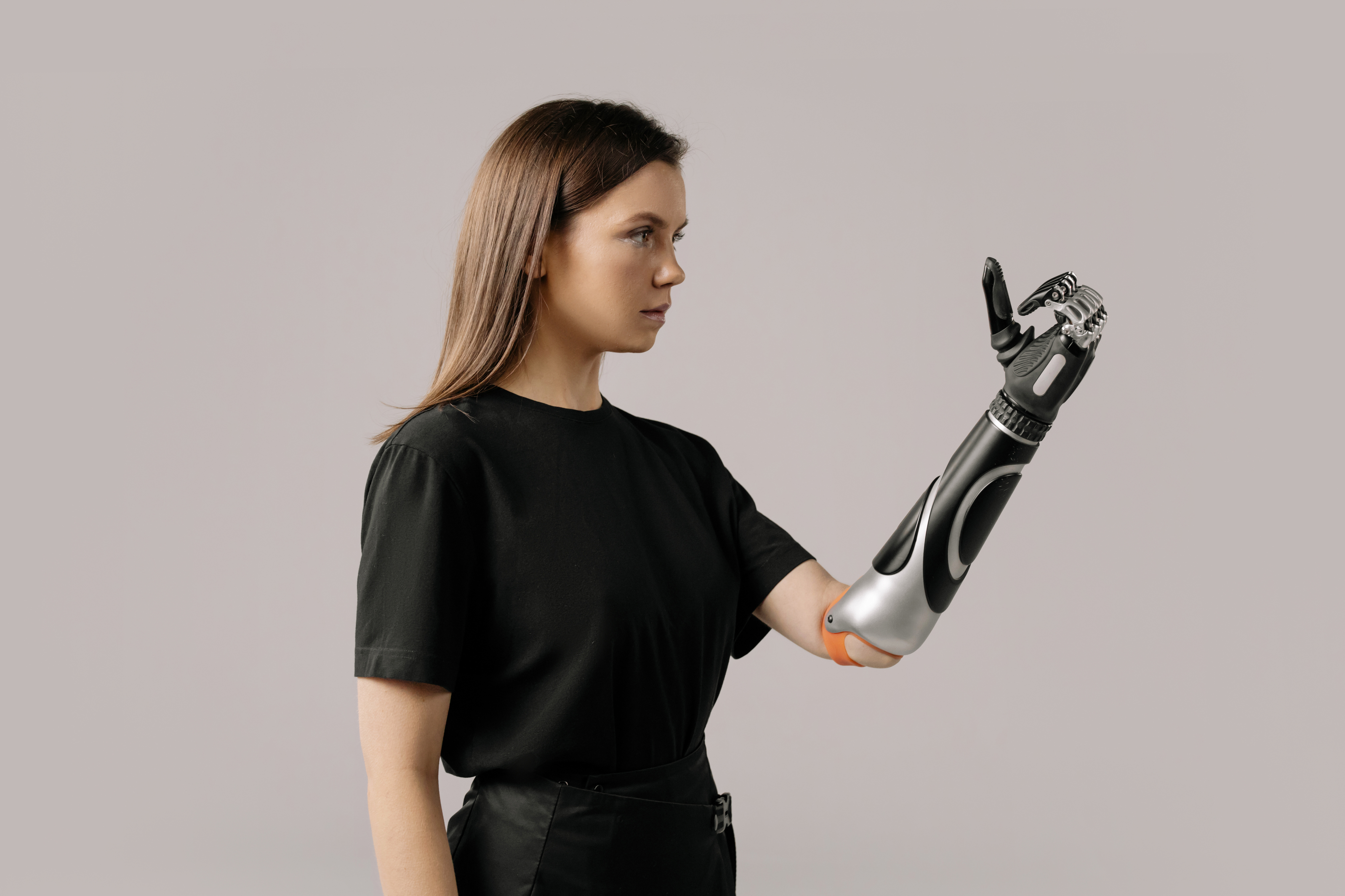 A Woman With a Prosthetic Arm 